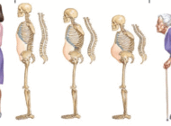 Người Việt loãng xương vì khẩu phần và thói quen ăn uống