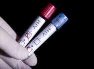 <b>Cuba xóa bỏ thành công lây nhiễm virus HIV từ mẹ sang con</b><br />Cuba đã trở thành nước đầu... Cuba xóa bỏ thành công lây nhiễm virus HIV từ mẹ sang con